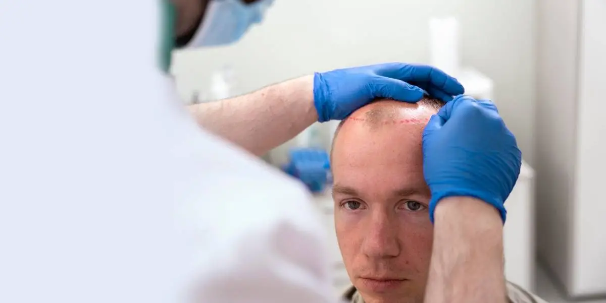 Hair Transplant Cost in India