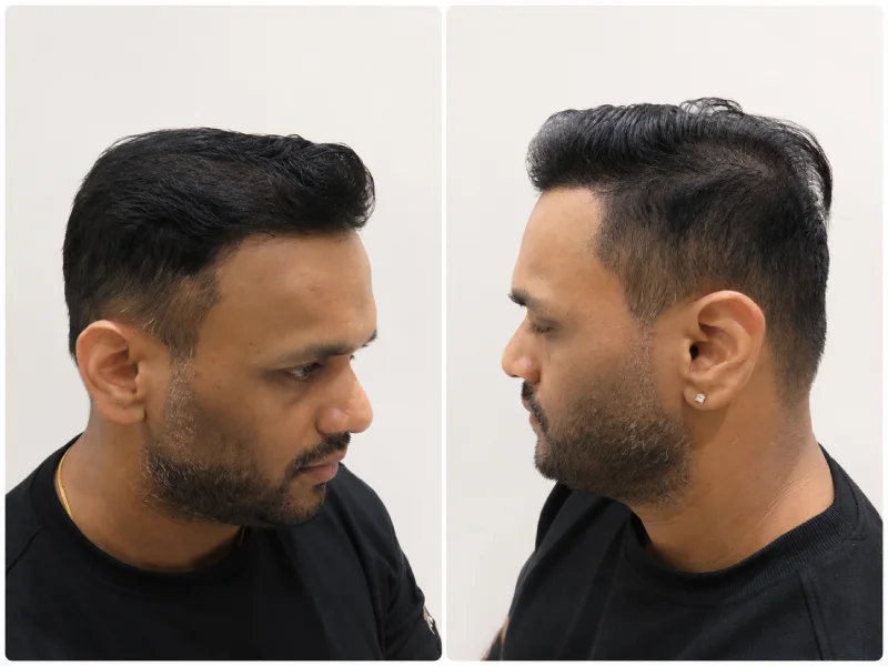 Three to Six Months