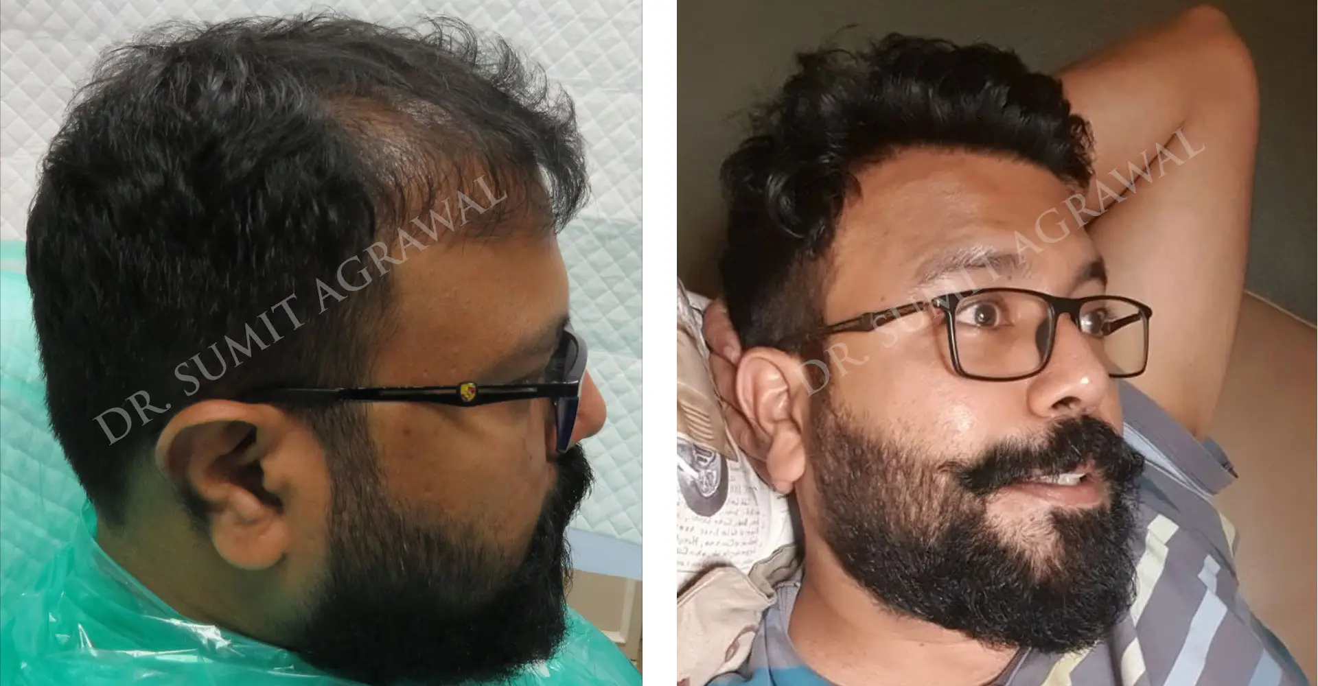 Revision Results Before and After 