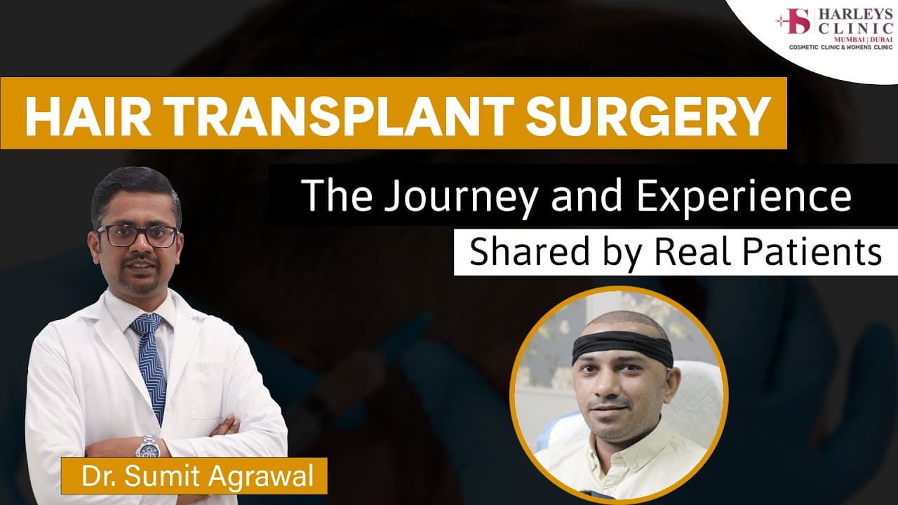 Hair Transplant in Mumbai  Hair Transplant cost FUE doctors  Results