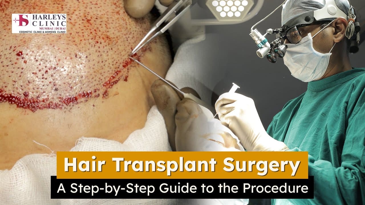 Hair Transplant Surgery | The Key to Restoring Your Youthful Appearance 