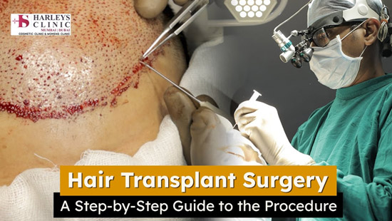 Hair Transplant Surgery 