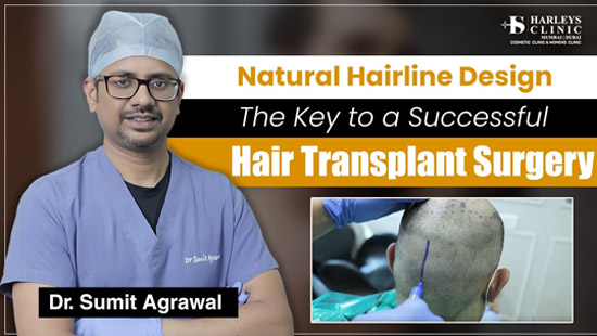 The Ultimate Guide to Hairline Designing | How to Create the Perfect Hairline 