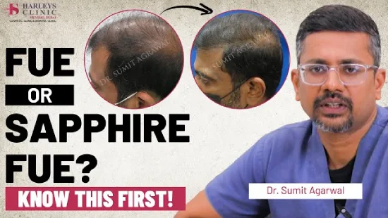 FUE vs Advanced Sapphire FUE: Which Hair Transplant Technique Is Better in 2025? | Dr Sumit Agarwal 