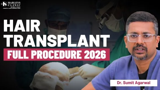  Hair Transplant Procedure Full Video | Step by Step HT Process (Real Patient) | HARLEYS CLINIC
