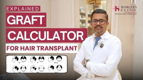 How to Know Your Grafts Needed for Hair Transplant? Norwood-Hamilton classification guide 