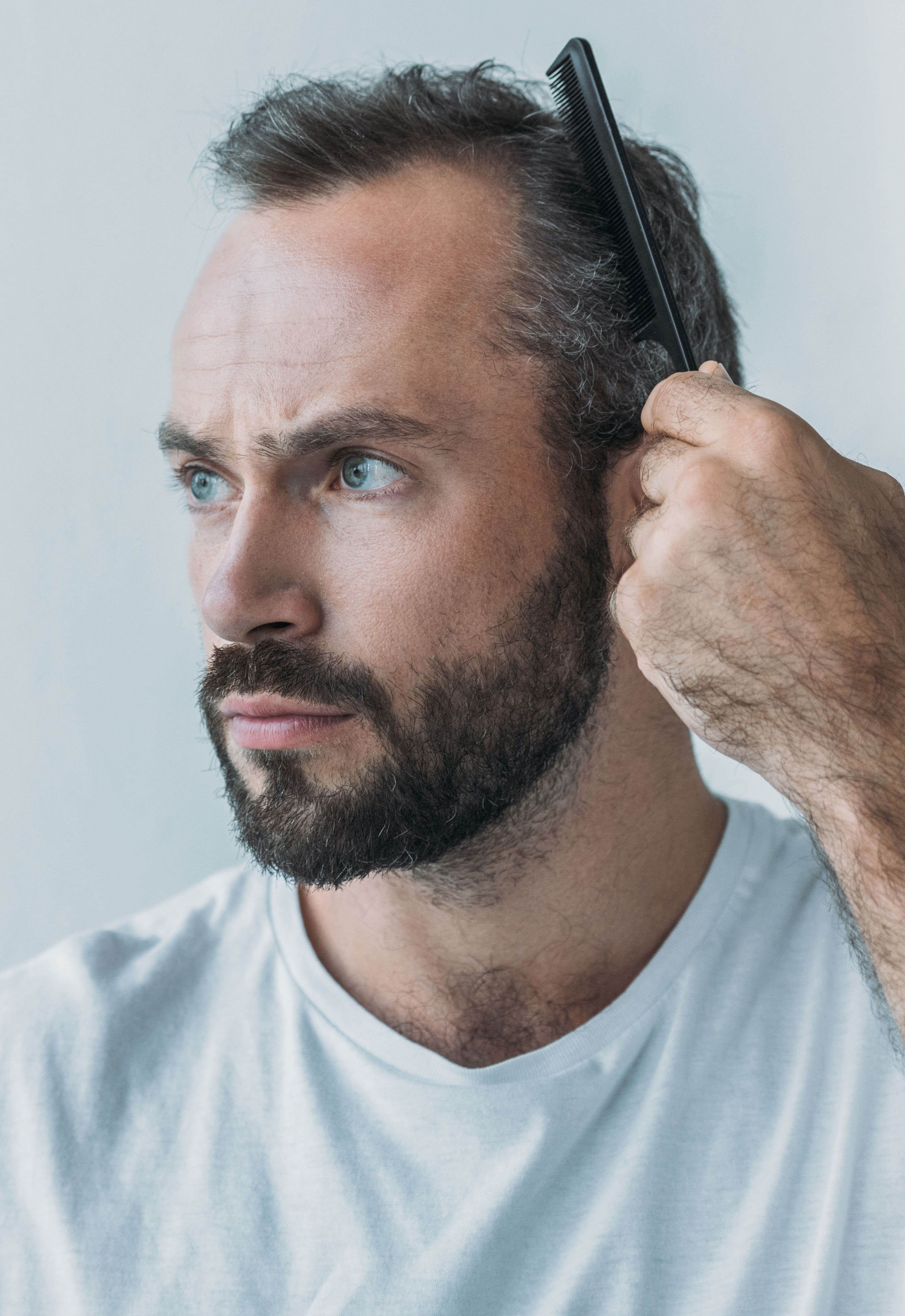 From Bald To Bold? Will Arnett'S Hair Transplant Speculation - gqfwiry